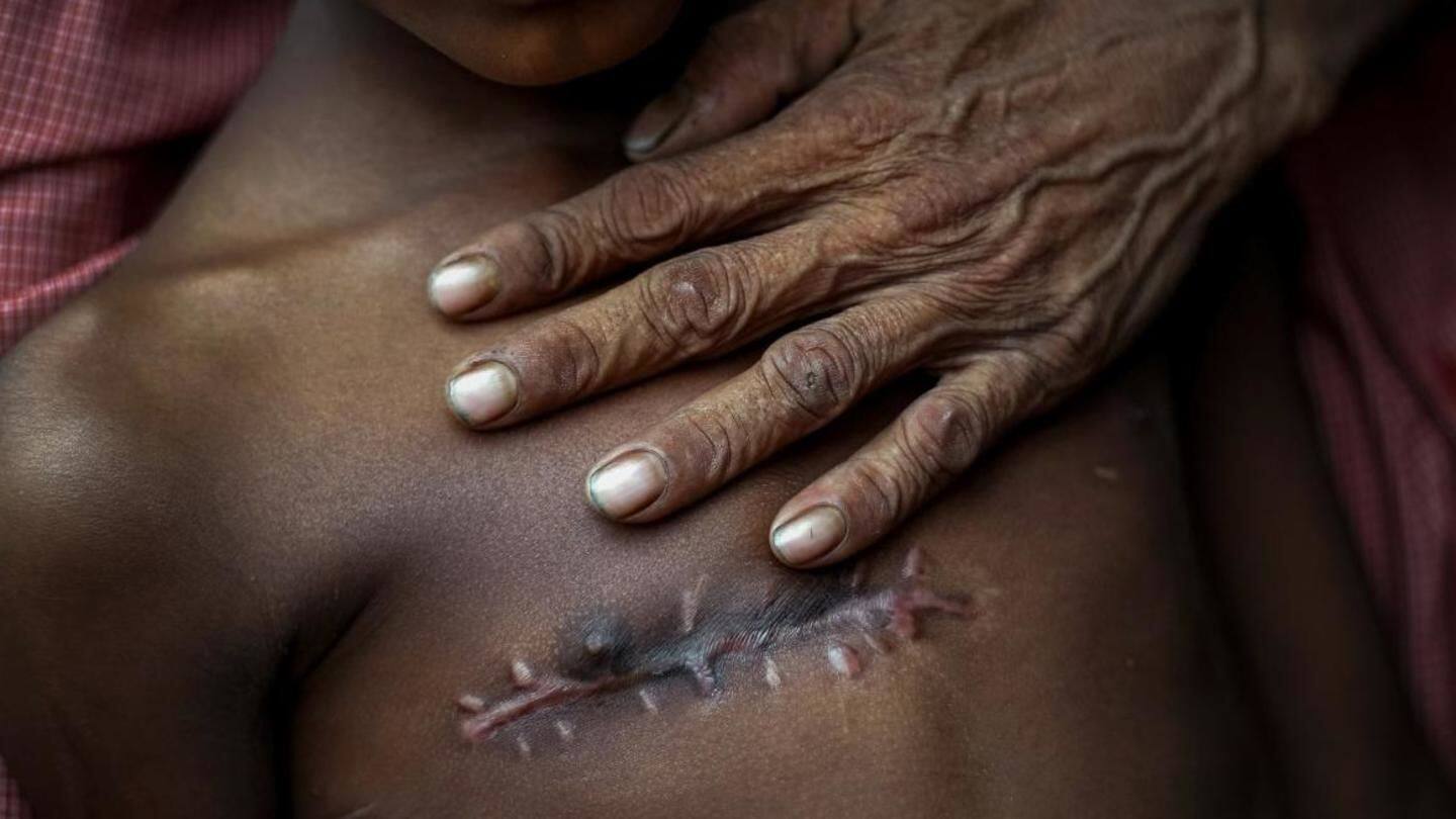 Abidi's image of a young boy's scar-ridden chest hits you Abidi's image of a young boy's scar-ridden chest hits you