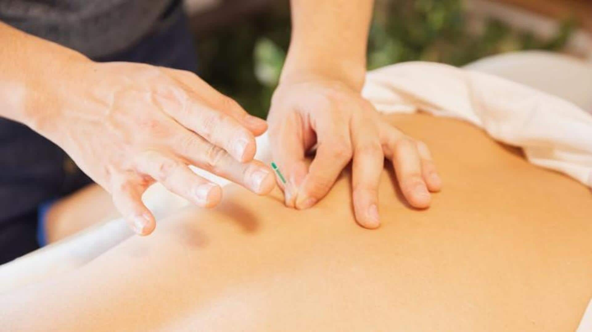 Busting popular myths about acupuncture 