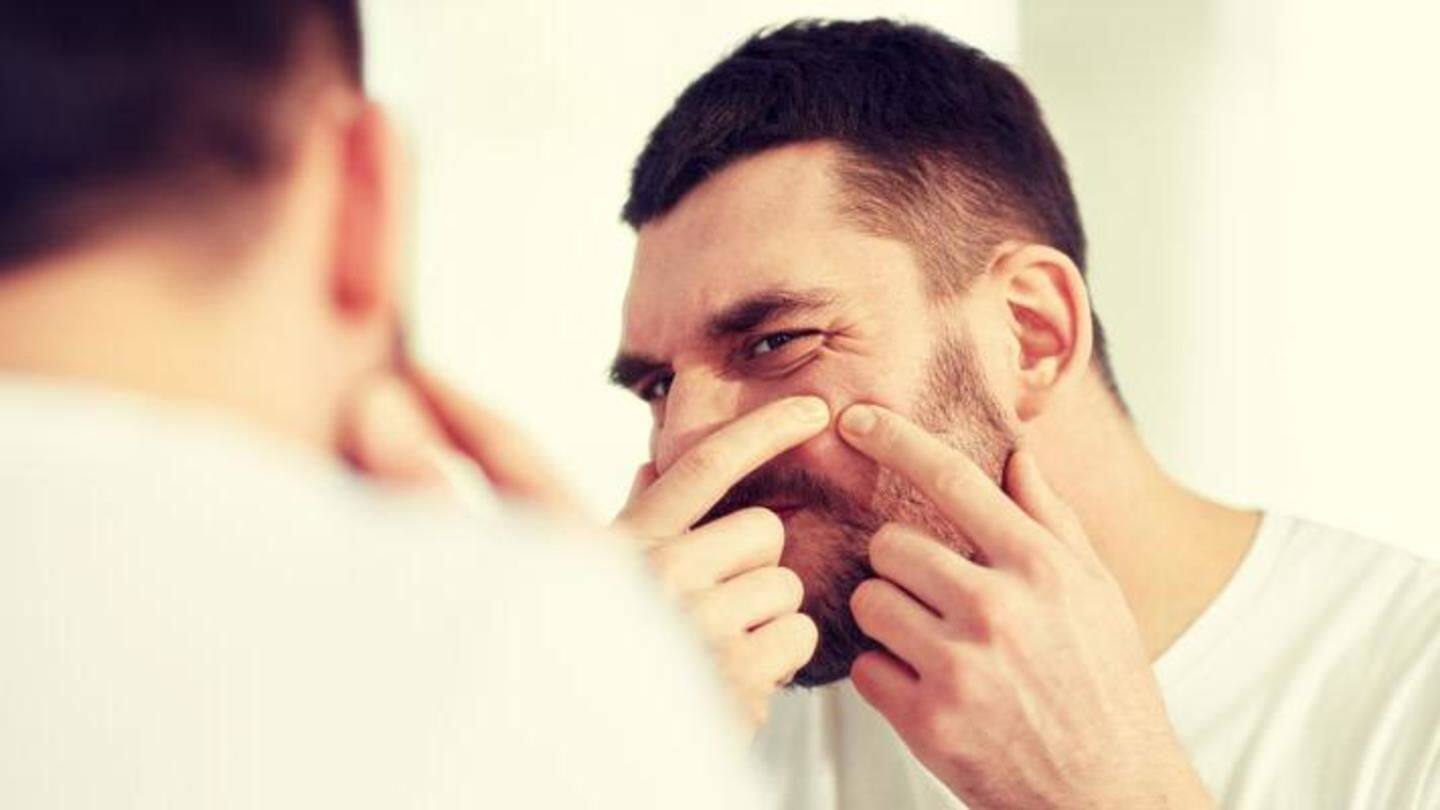 #HealthBytes: Acne in men: Causes and treatment