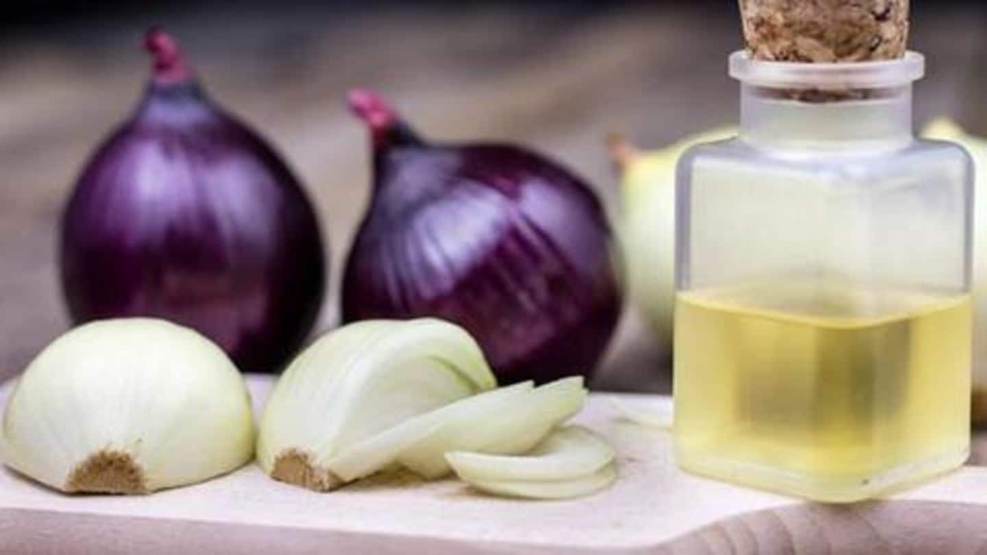 Here's how onion juice can help prevent hair loss