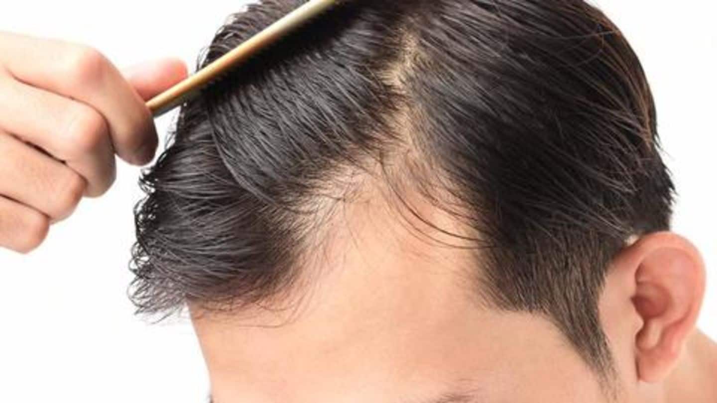 Hair loss: Causes and precaution tips