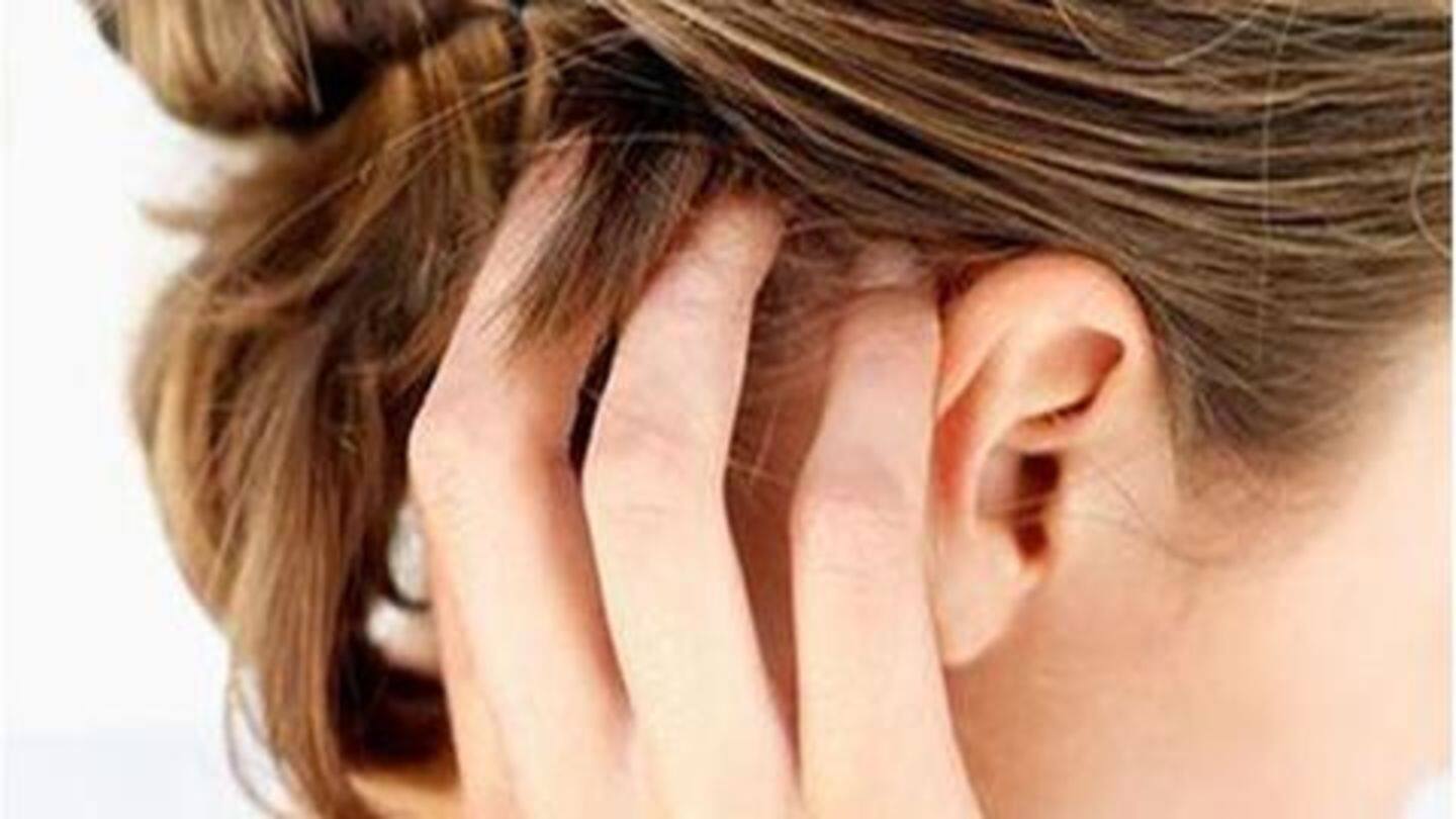 #HealthBytes: 5 natural home-remedies to treat dry scalp