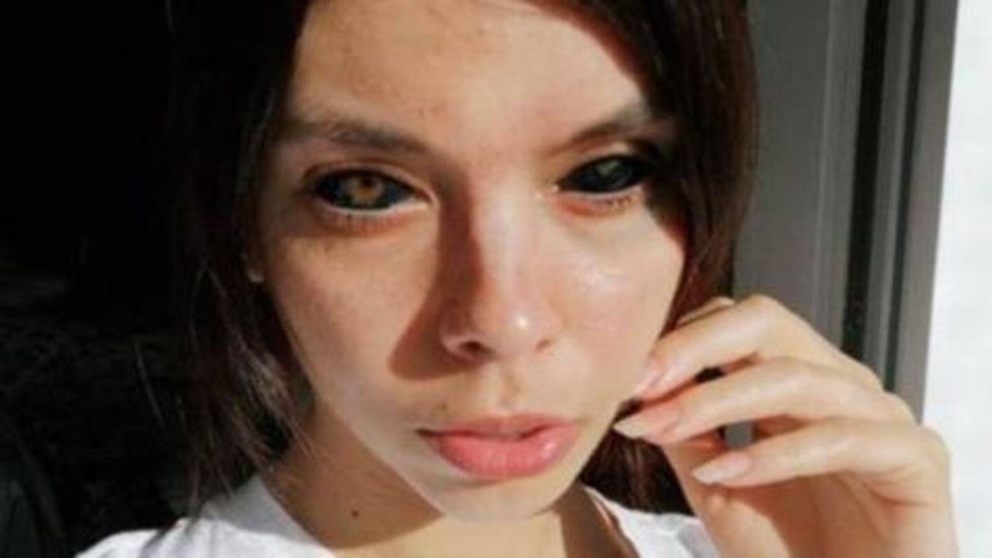Model gets her eyeballs tattooed black, loses eyesight