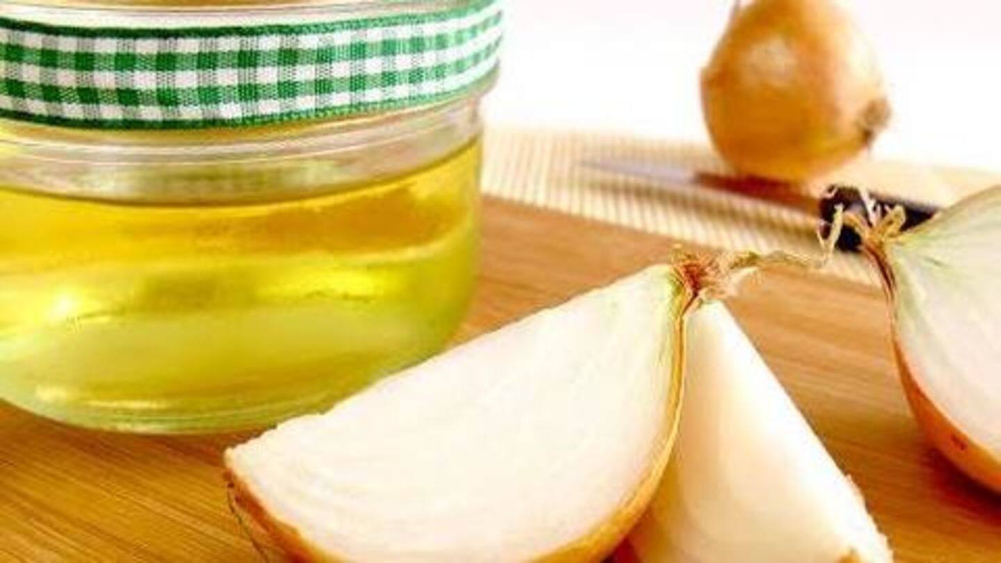 Here's how onion juice can help prevent hair loss NewsBytes