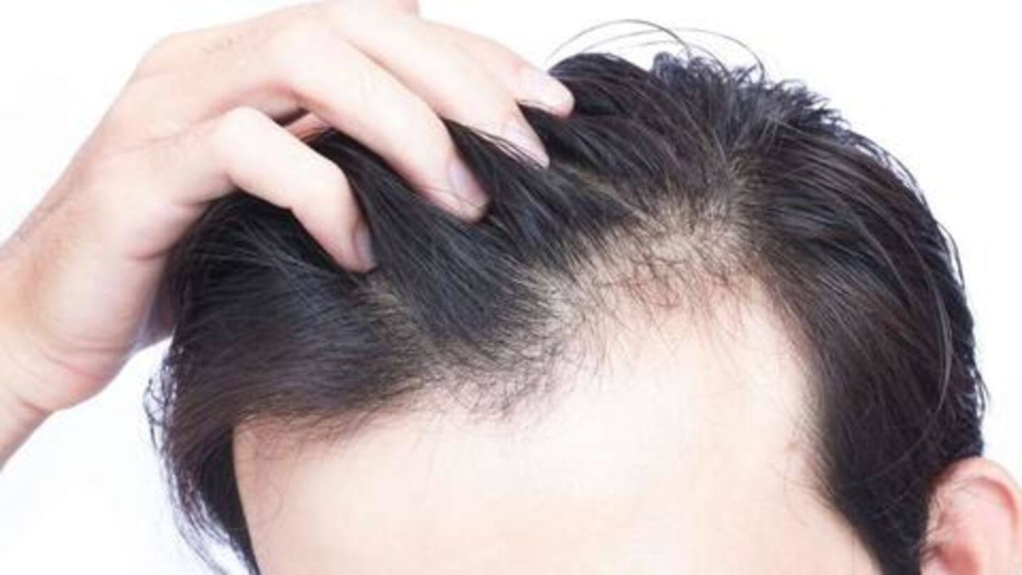 Causes of hair loss: Heredity, certain medications, and stress Causes of hair loss: Heredity, certain medications, and stress