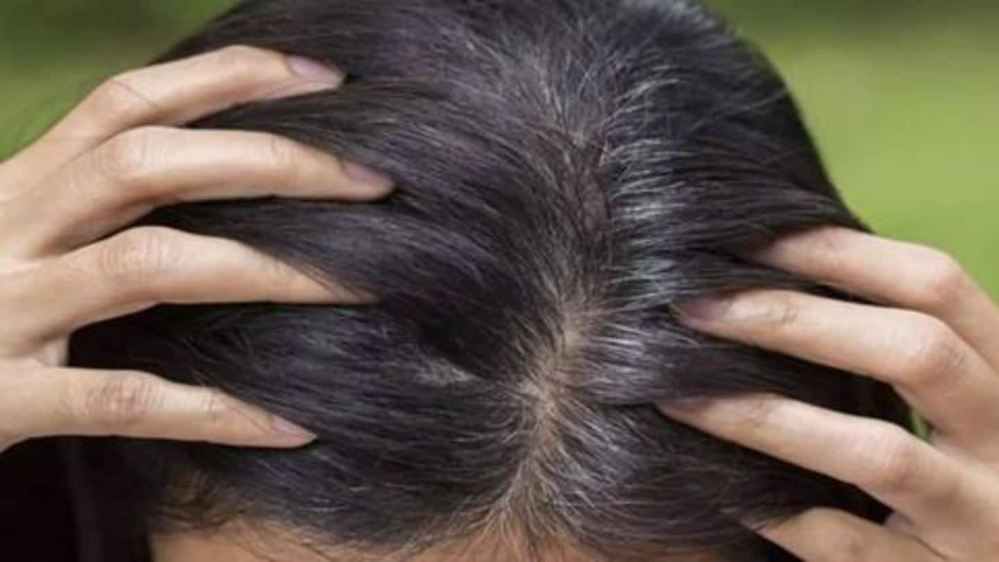 Hair Turning Grey Try These Five Natural Home Remedies Newsbytes