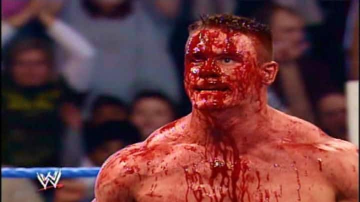 Fake sport, real pain: Major injuries suffered during WWE matches
