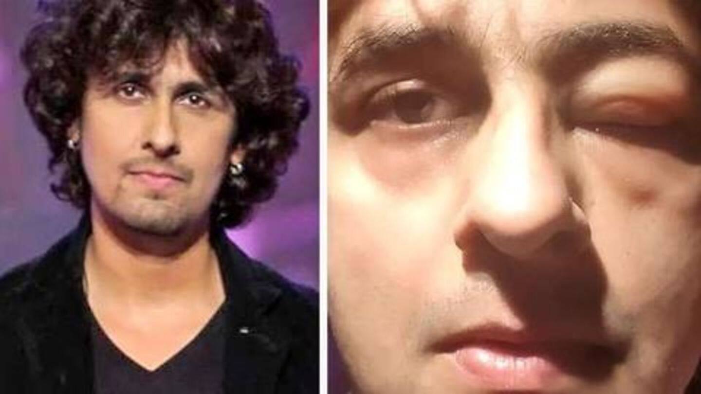 Early this month, Sonu was hospitalized for sea-food allergy Early this month, Sonu was hospitalized for sea-food allergy