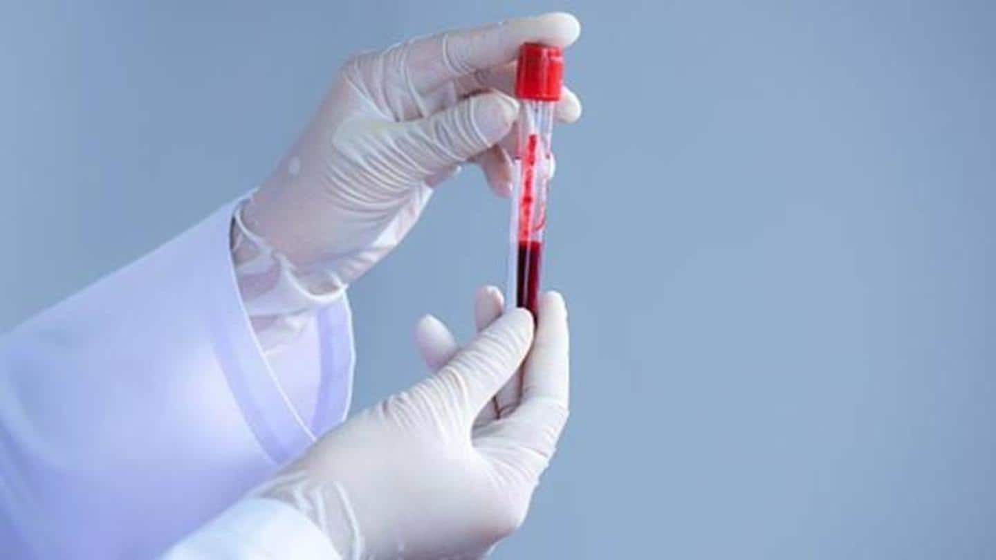 Delhi plans to begin random serological tests starting June 27