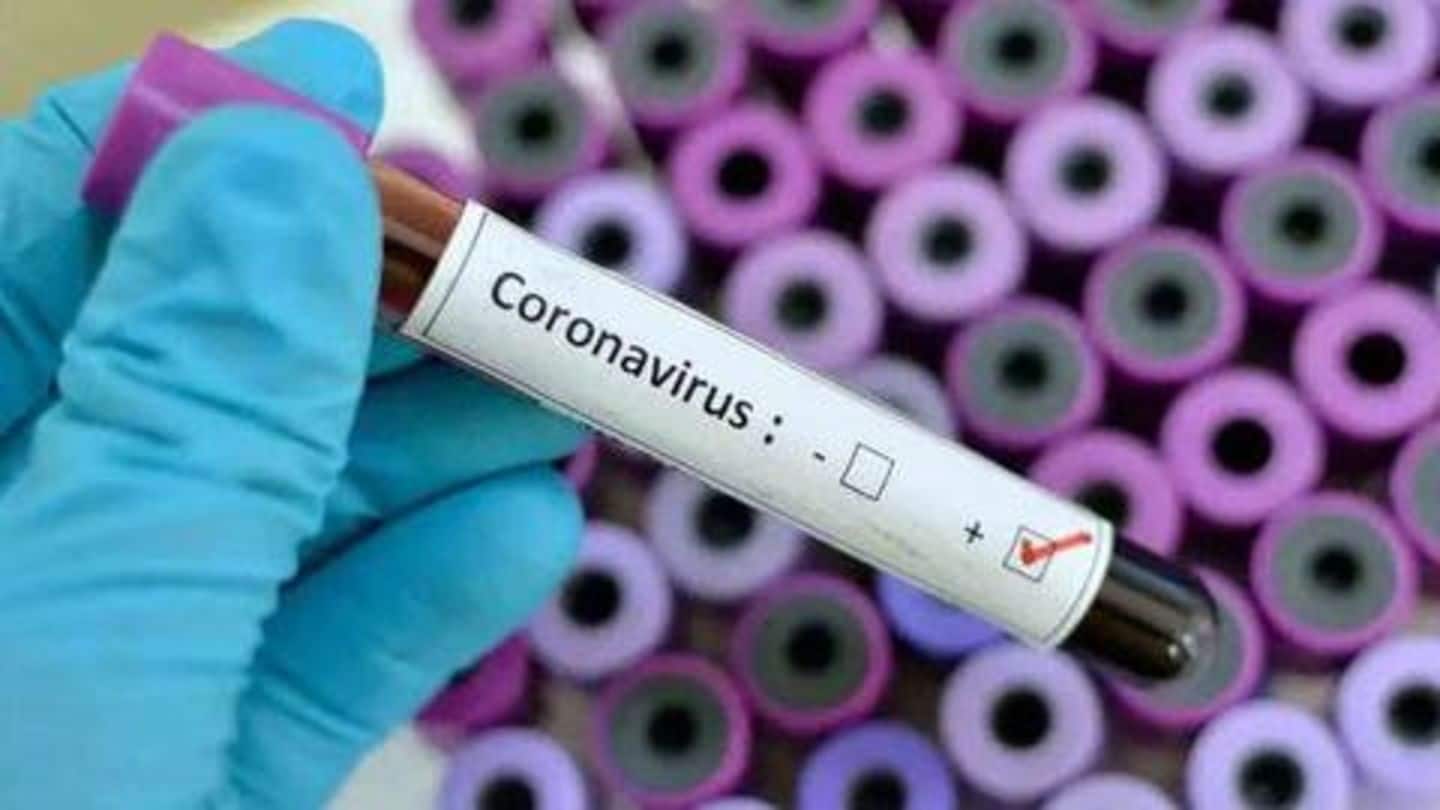 Scientists develop test to detect COVID-19 in 5 minutes