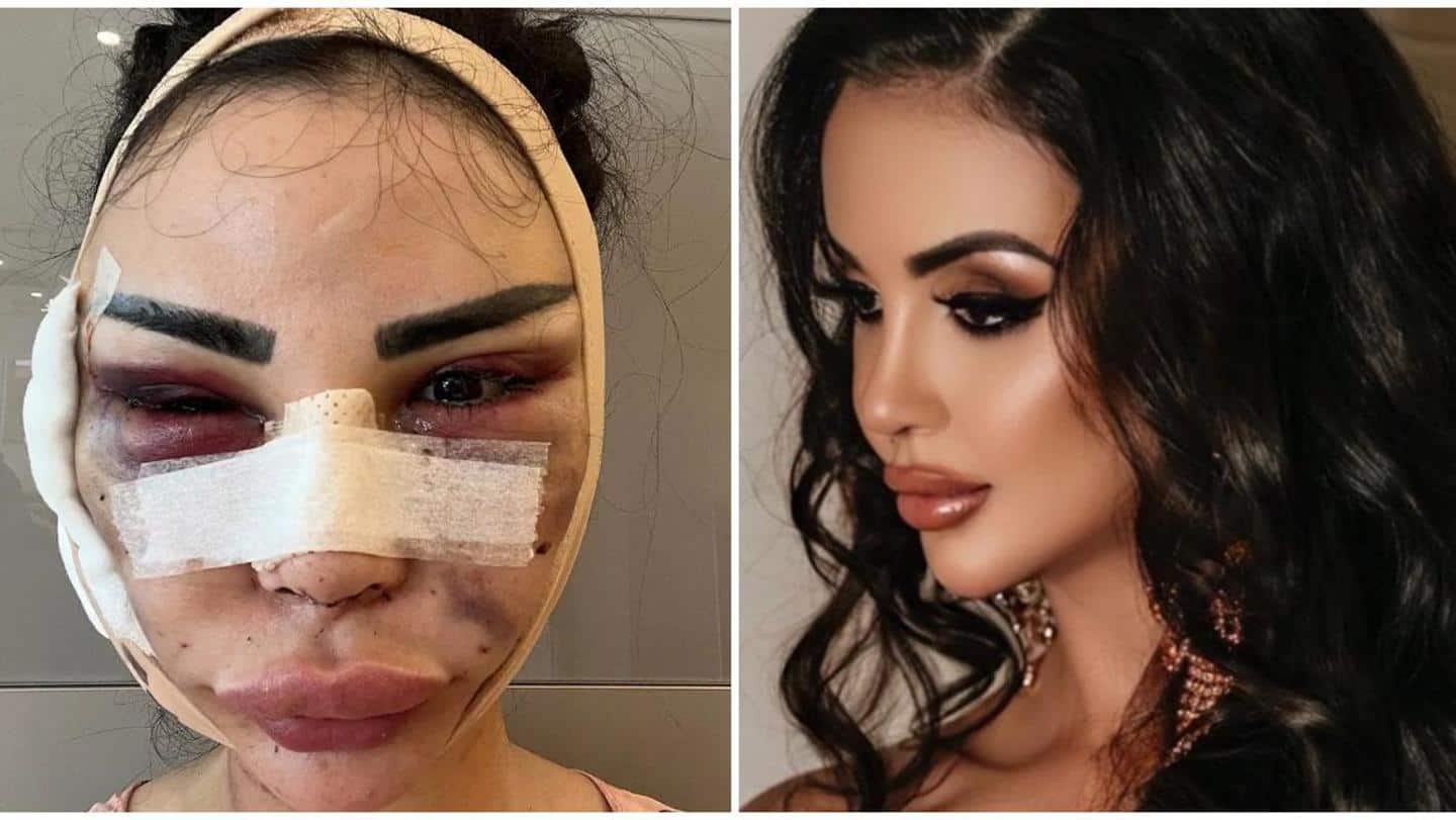 Model, who spent $600K to resemble KimK, undergoing $120K-worth 'detransition'