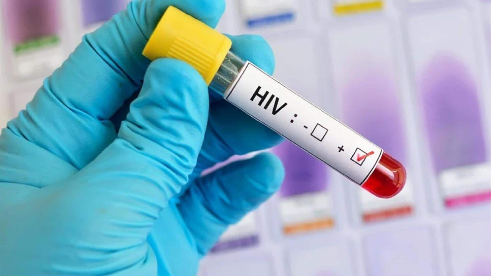 Over 19 men contract HIV after sexual relations with minor