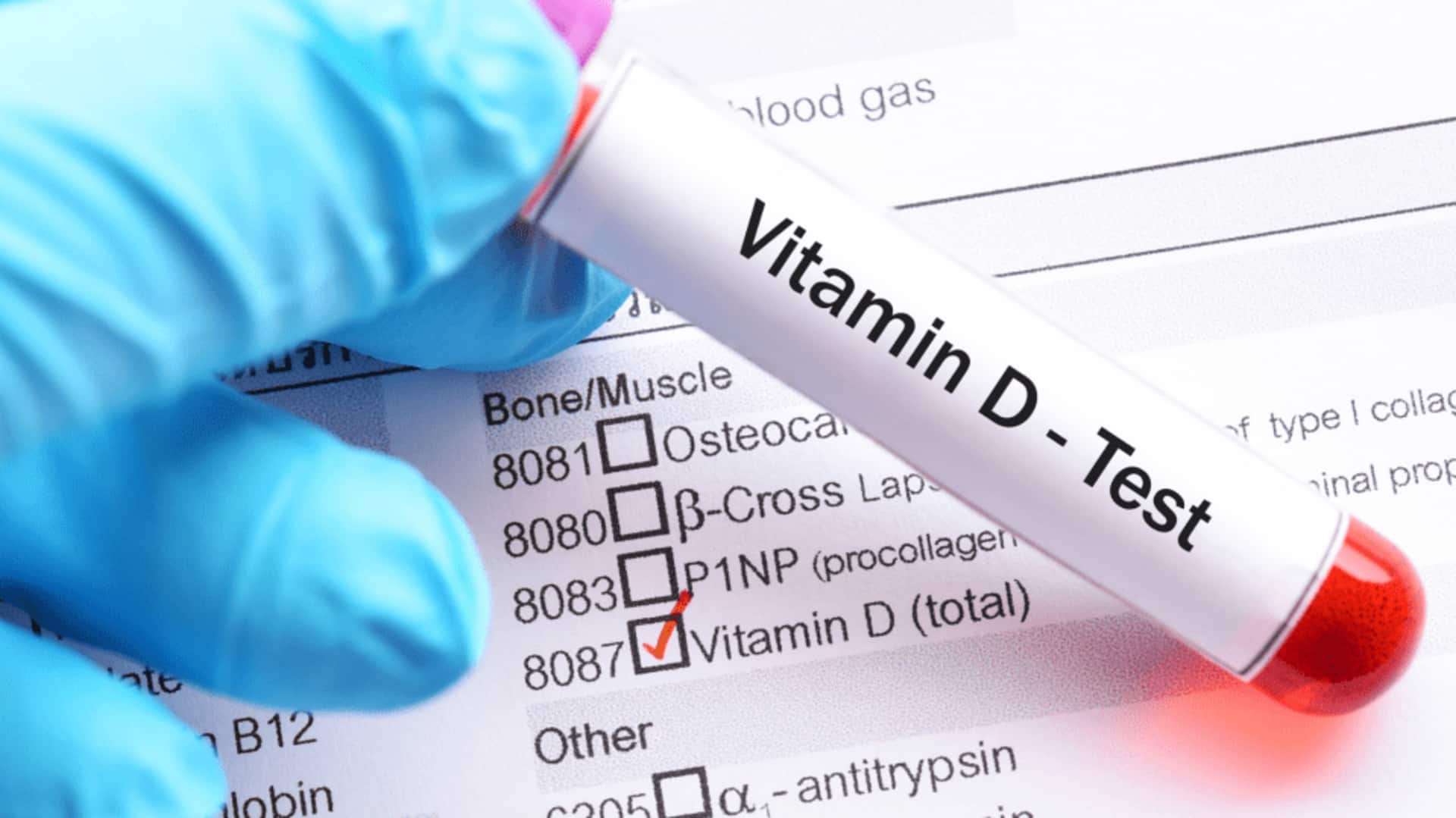 Studies suggest kids with autism may have lower vitamin-D levels Studies suggest kids with autism may have lower vitamin-D levels