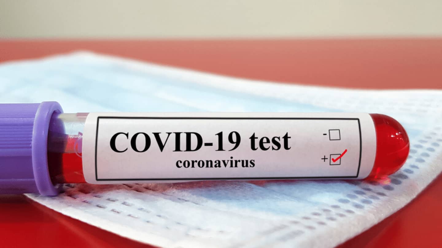 Coronavirus: Testing negative probably isn't the free pass you think