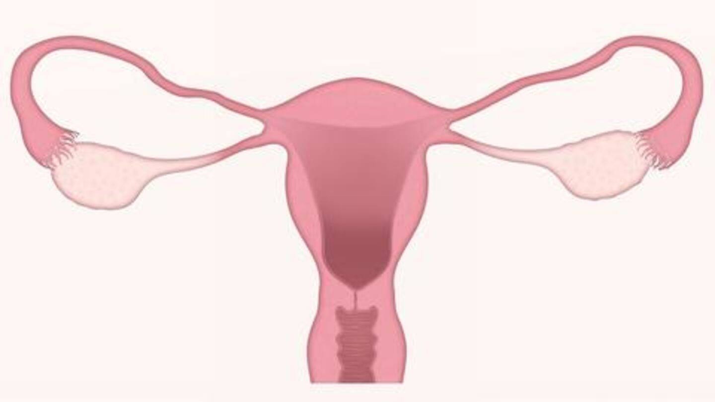 Hysterectomies conducted to treat uterine fibroids, endometriosis Hysterectomies conducted to treat uterine fibroids, endometriosis