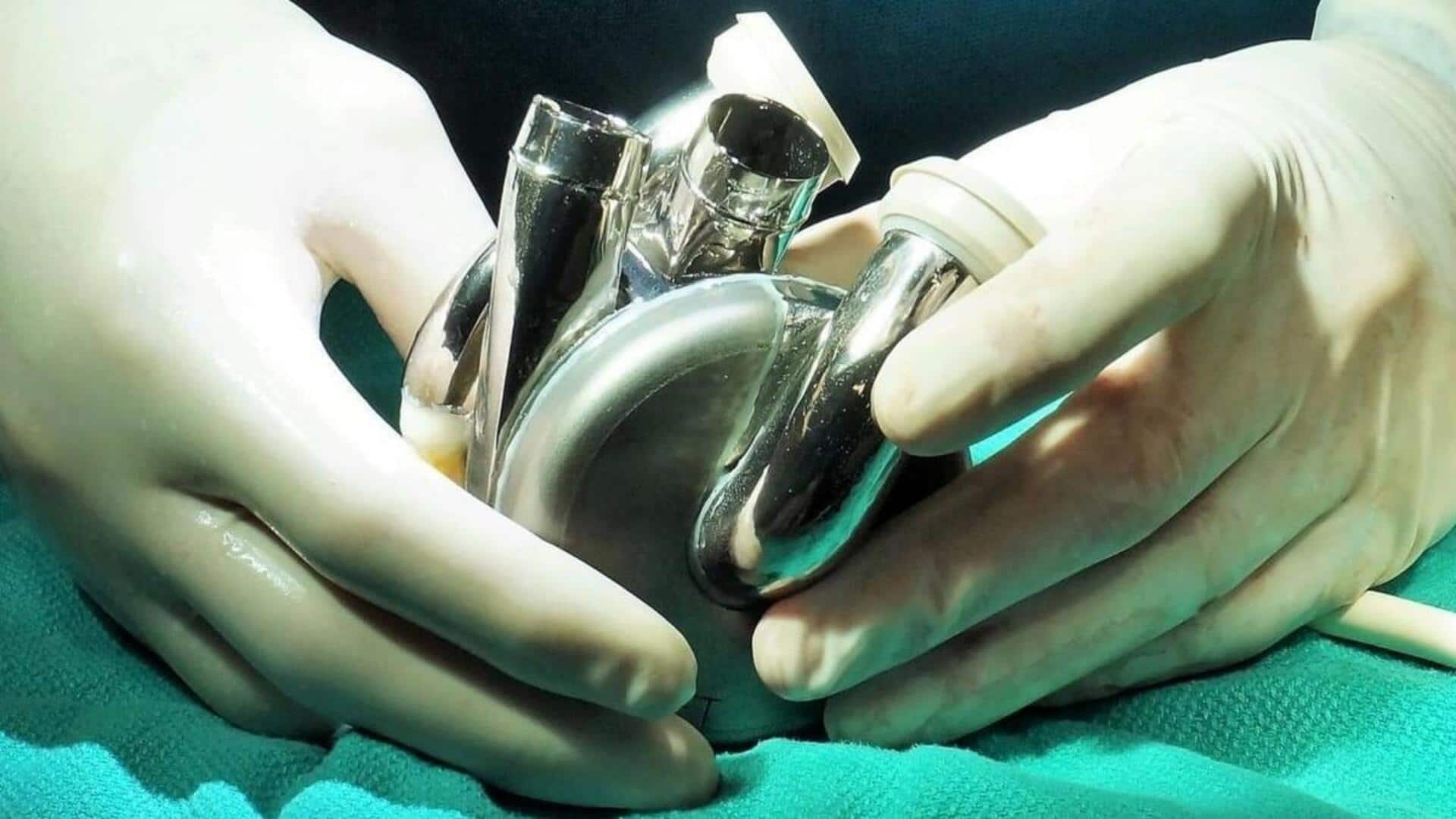 First-in-the-world: Australian man lives with titanium heart for 105 days