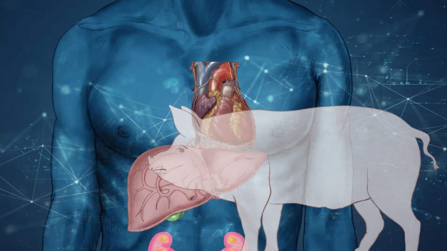China: Combined transplant of pig liver, kidney to human performed