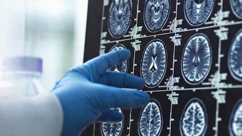 How China plans to tackle rising number of Alzheimer's cases