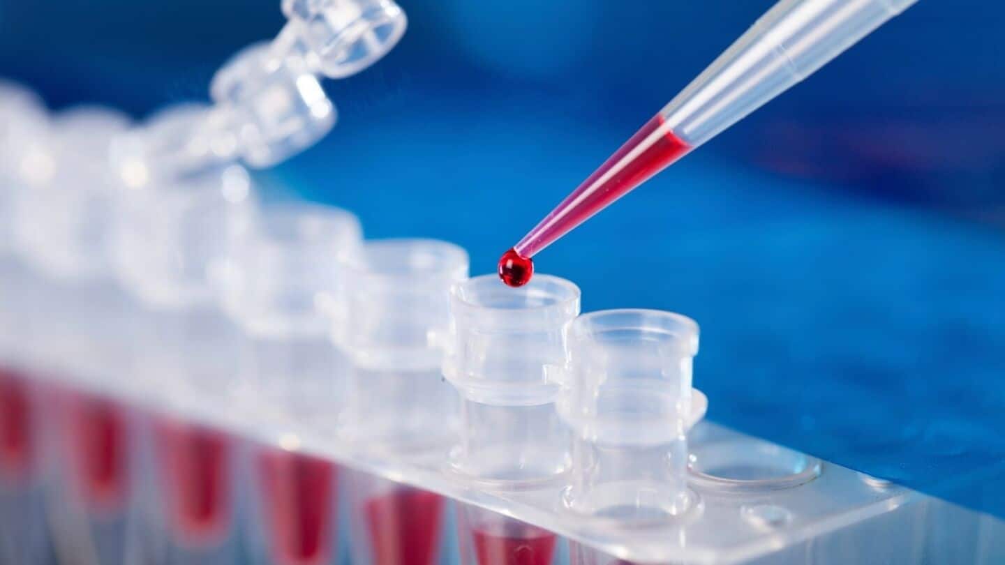 This glowing paper sensor by IISc can detect liver cancer This glowing paper sensor by IISc can detect liver cancer