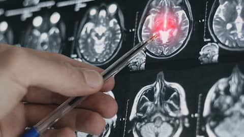 This AI model can predict your depression 4 years early