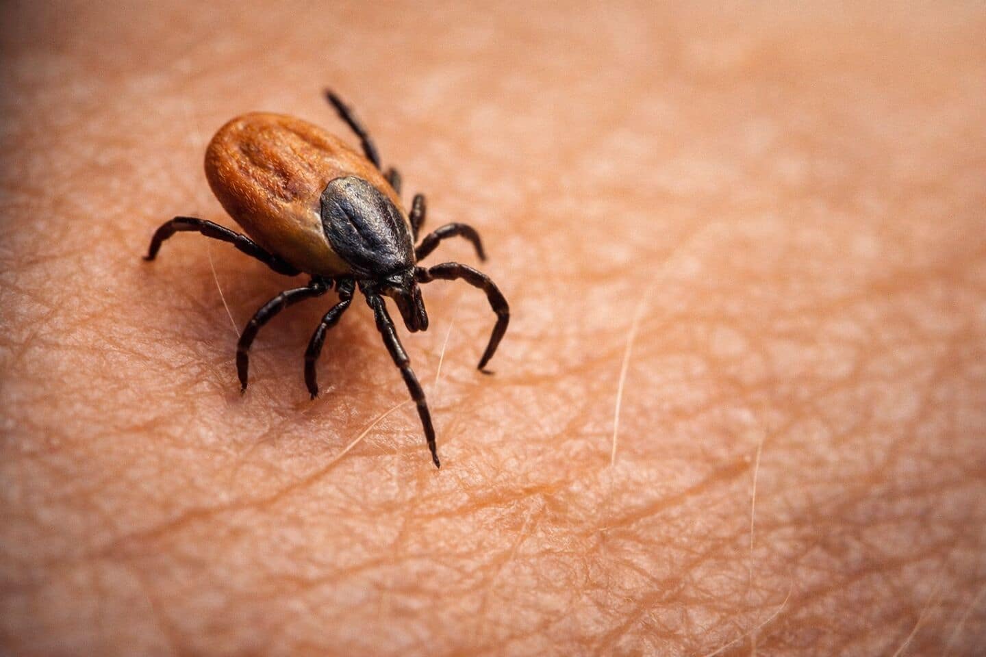 This disease with high mortality rate finally has a cure 