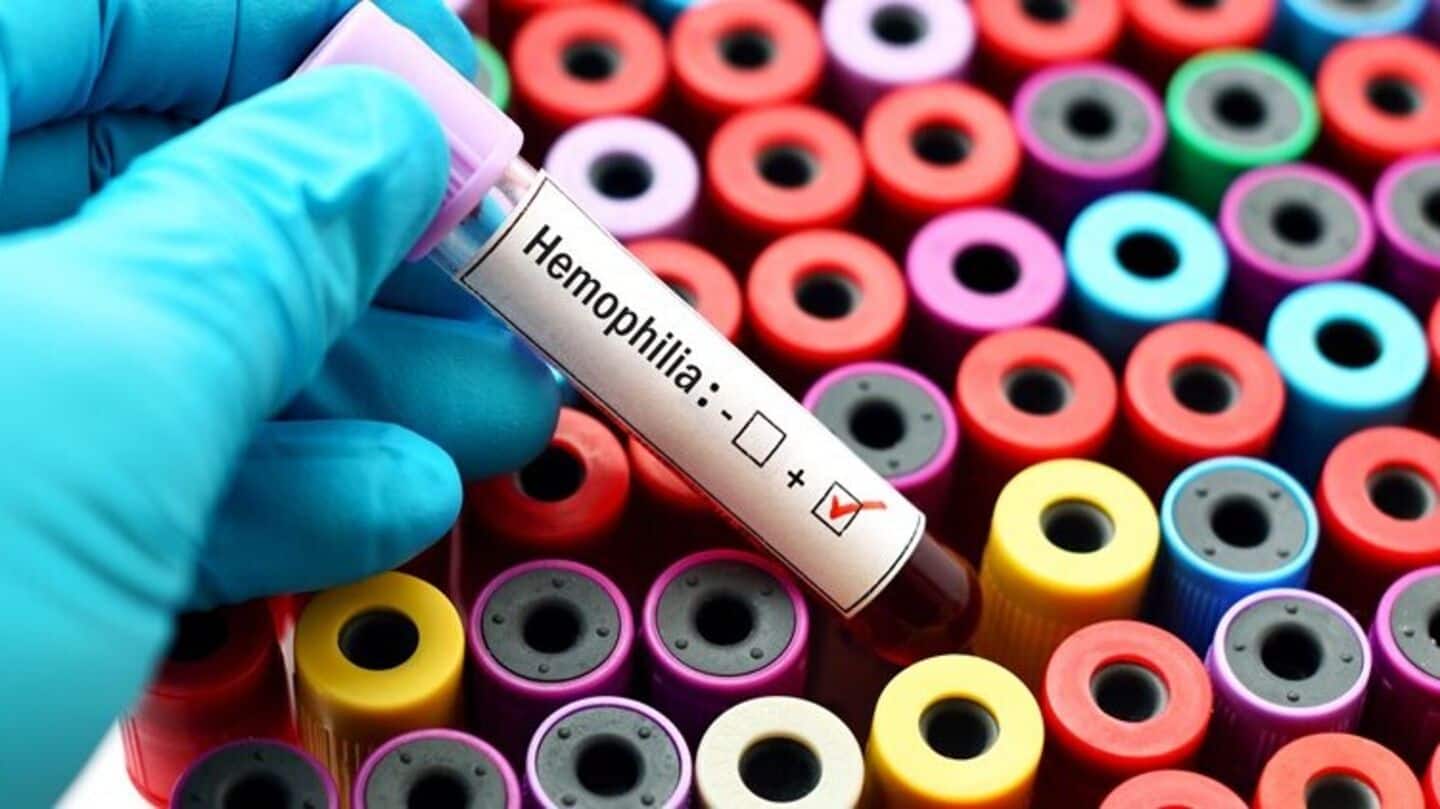ICMR's latest test can diagnose hemophilia at just ₹580