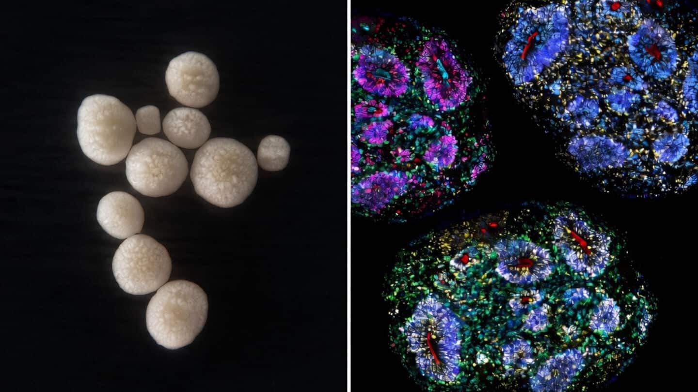 This lab-grown human brain can live for nearly 7 years