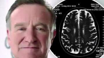'Robin's Wish' shows us why Robin Williams took his life