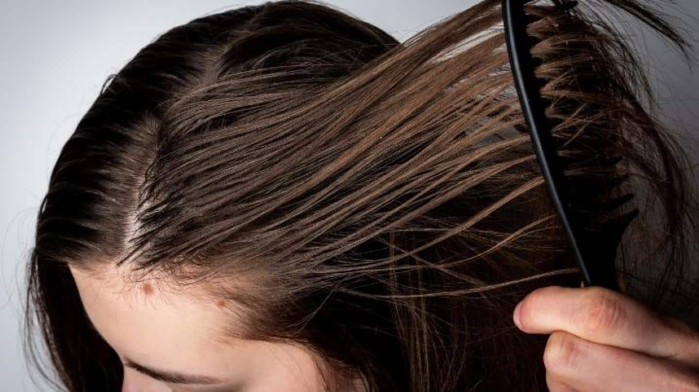 Tips to help you get rid of greasy hair problems