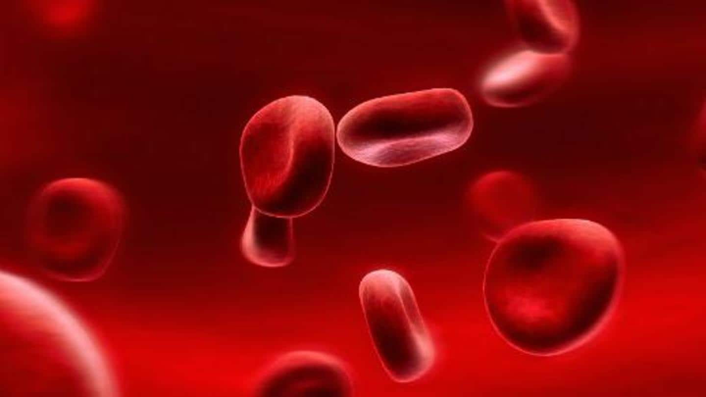Iron deficiency anemia: Symptoms, causes, treatment, and prevention