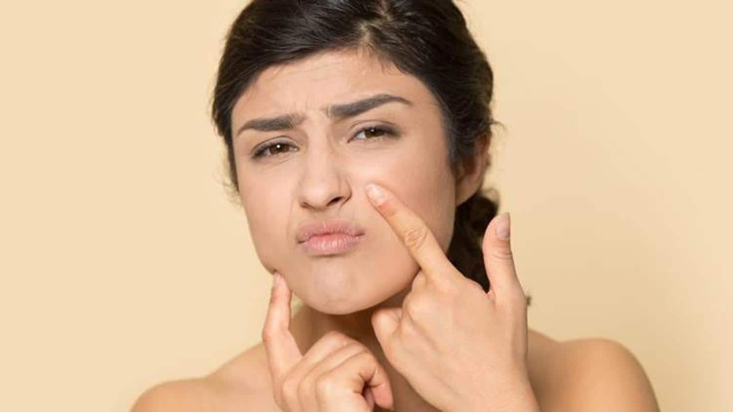 #HealthBytes: What can you do to fight dry skin