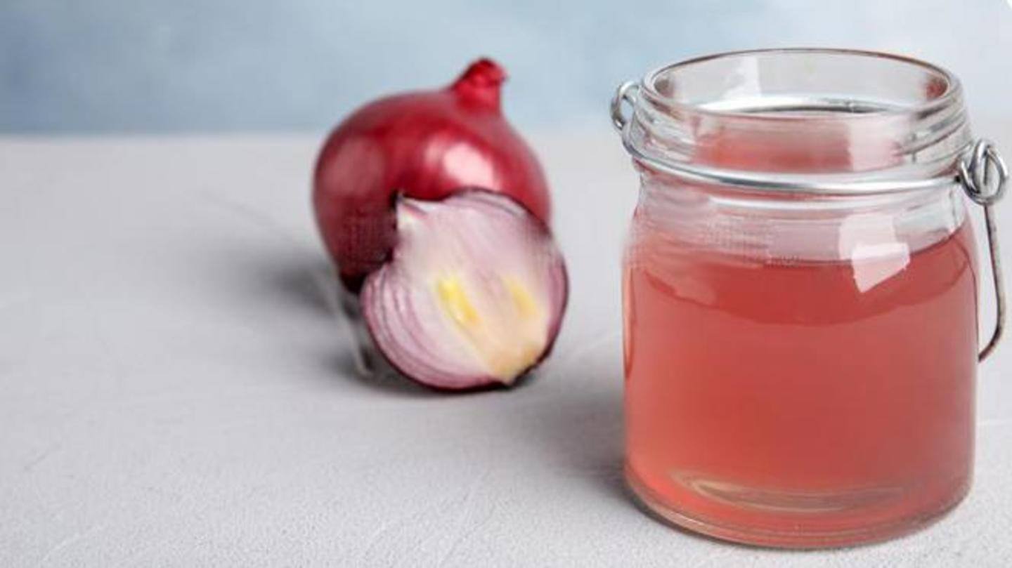 The sulphur-rich onion juice may help in good hair growth The sulphur-rich onion juice may help in good hair growth