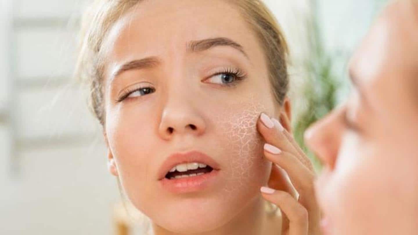 #HealthBytes: How to prevent dry skin during winter