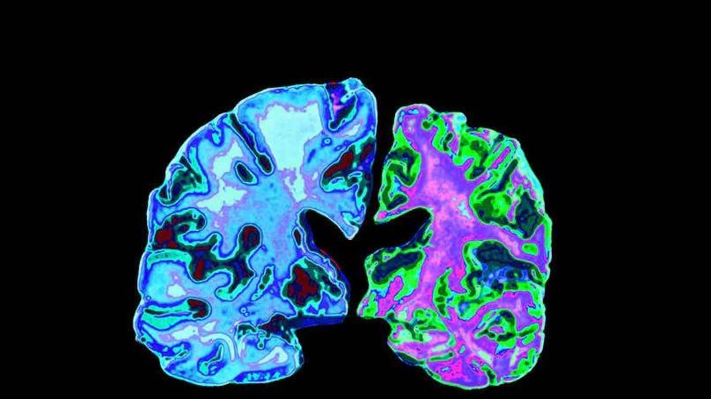Contains niacin that protects against Alzheimer's and other neurodegenerative diseases Contains niacin that protects against Alzheimer's and other neurodegenerative diseases