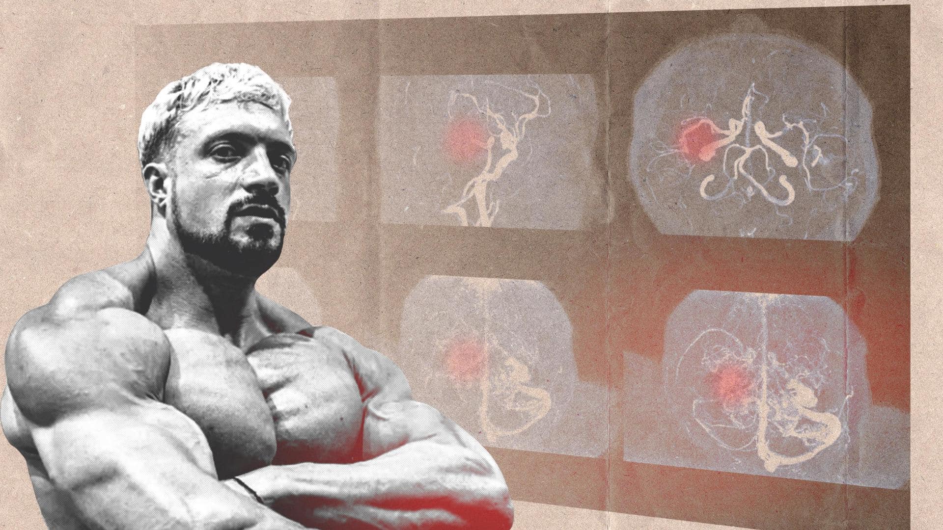 Understanding aneurysm: Condition that took bodybuilder-influencer Jo Lindner's life