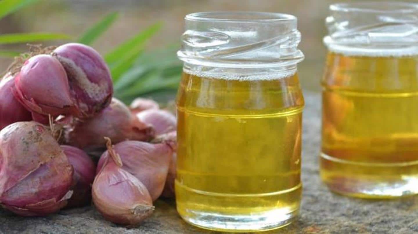 Apply onion juice to the scalp twice a week Apply onion juice to the scalp twice a week