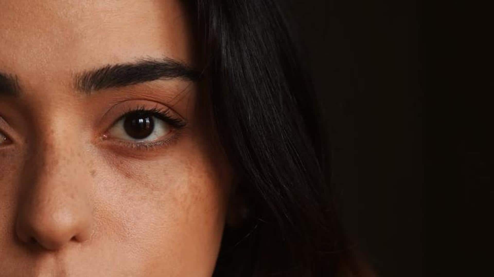 Fake freckles: Here's about the latest trend