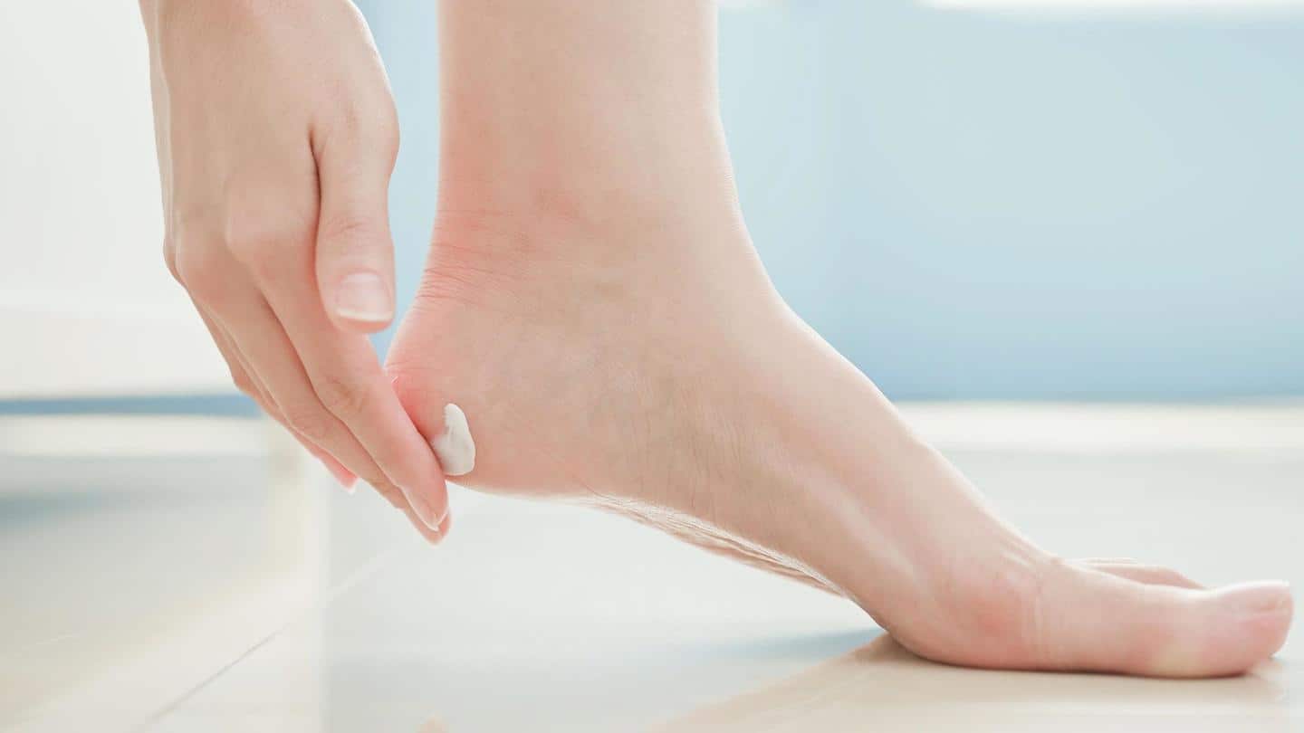 5 homemade foot creams for soft and smooth heels