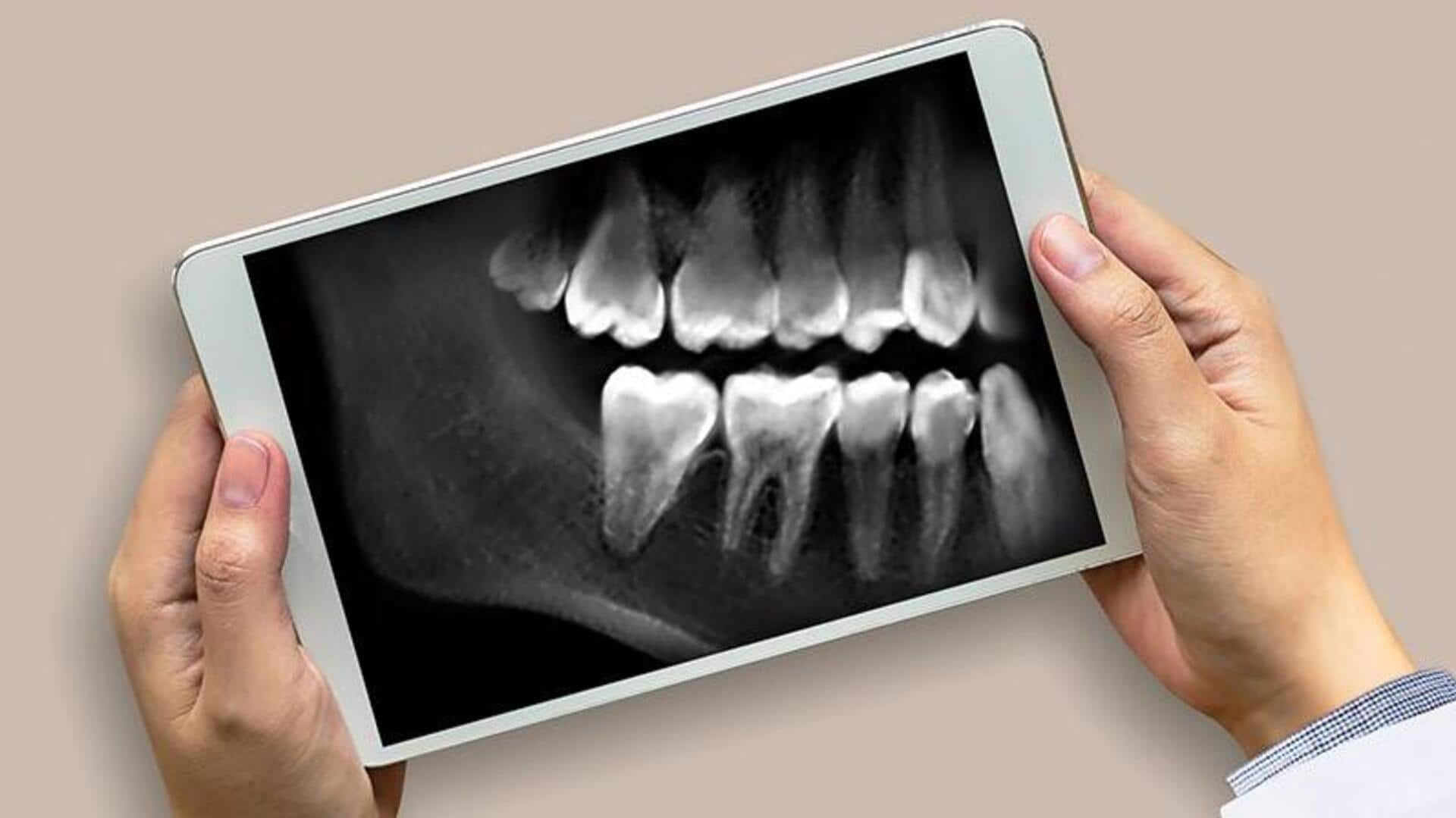 New AI tool can identify sex using dental X-rays 