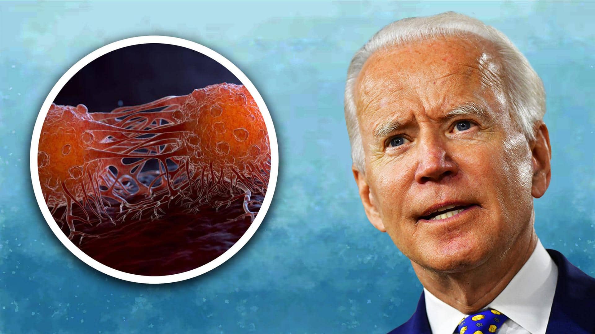 Joe Biden had cancerous skin lesion removed successfully in February