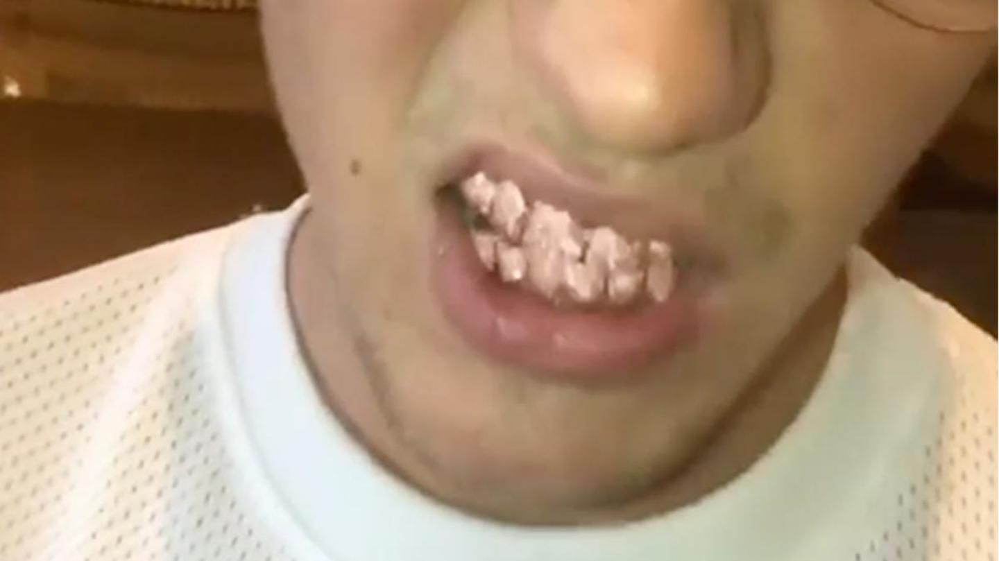 His $15,000 pink grills that shocked internet in 2017 His $15,000 pink grills that shocked internet in 2017