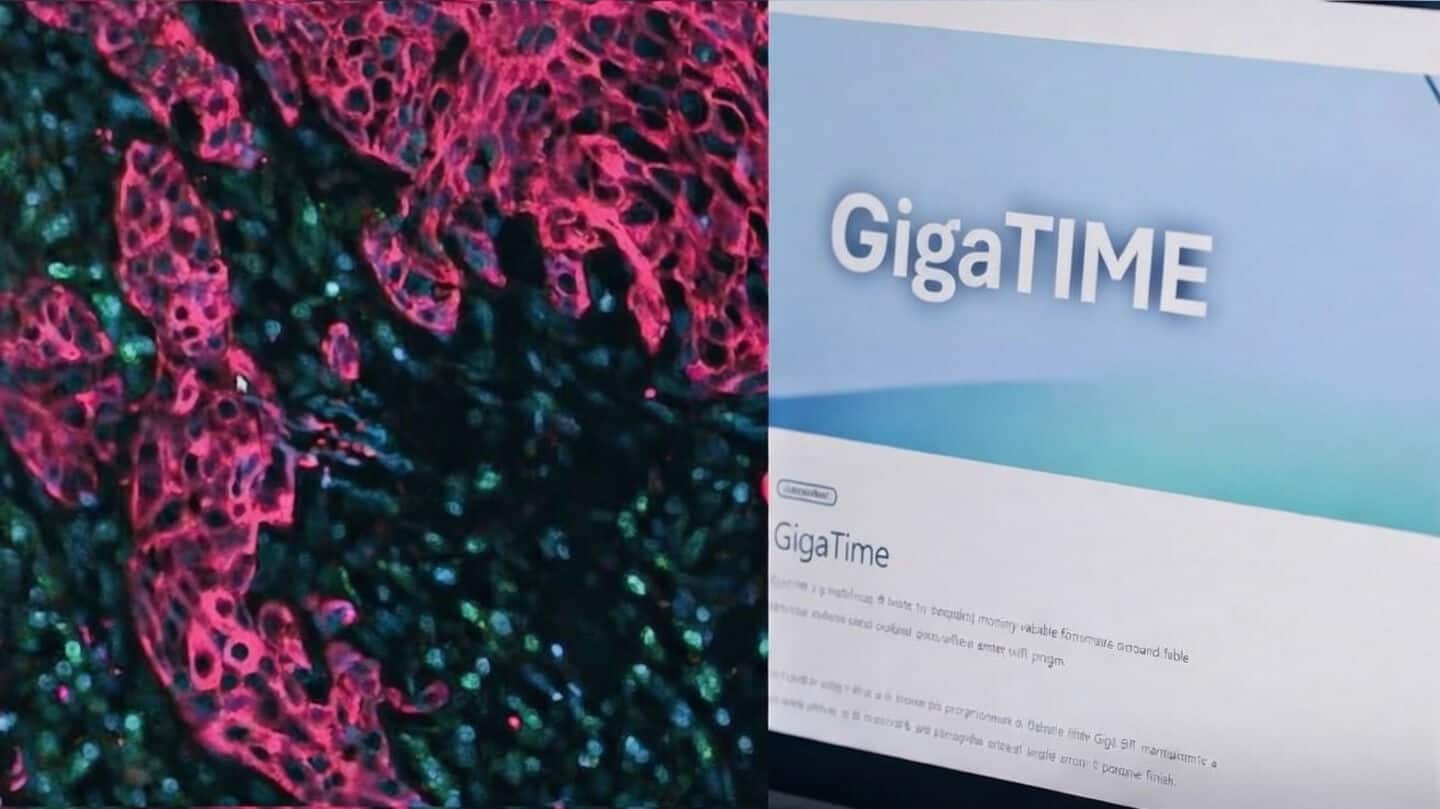 'GigaTIME': Microsoft's new AI could speed up cancer tissue analysis