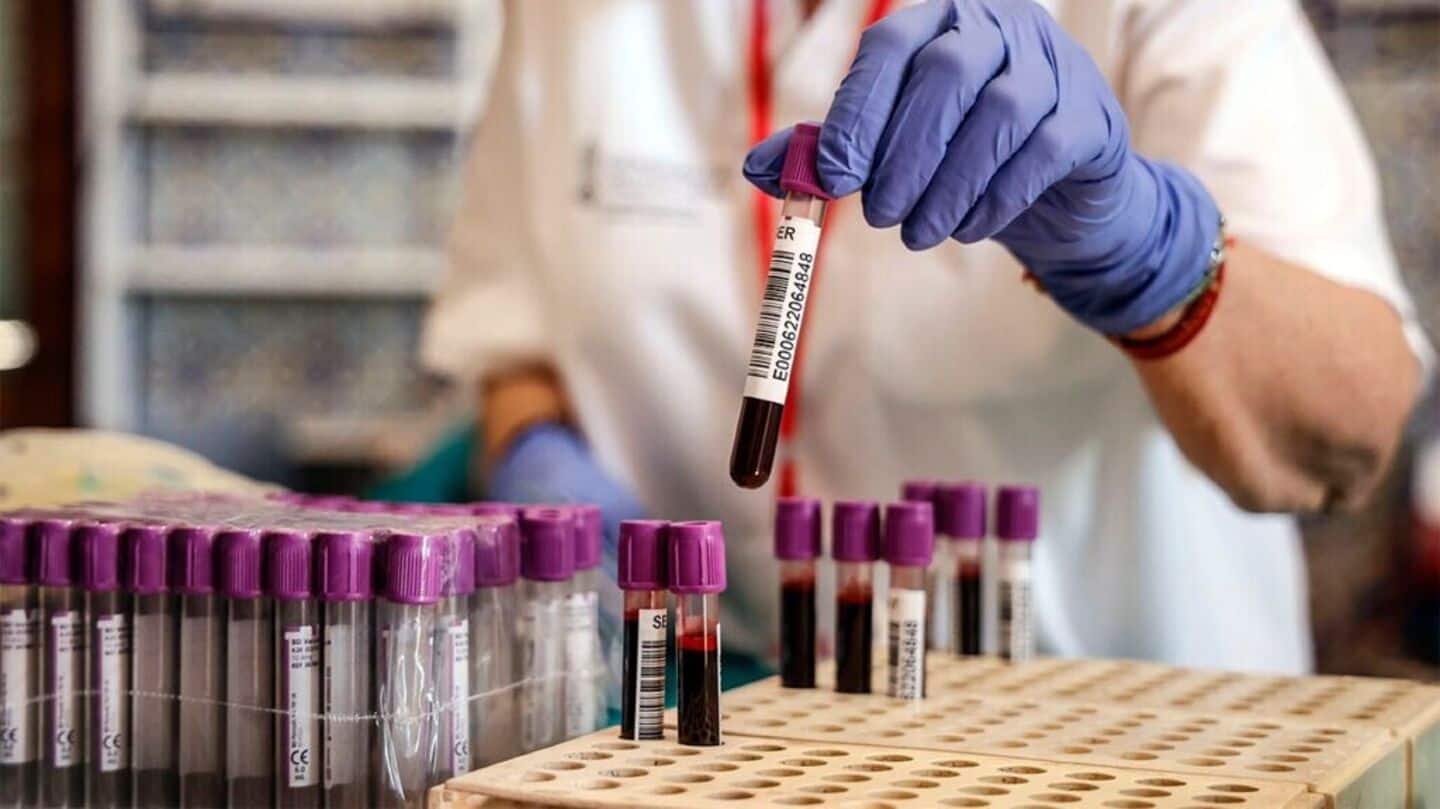 New blood test can detect Alzheimer's disease with high accuracy New blood test can detect Alzheimer's disease with high accuracy