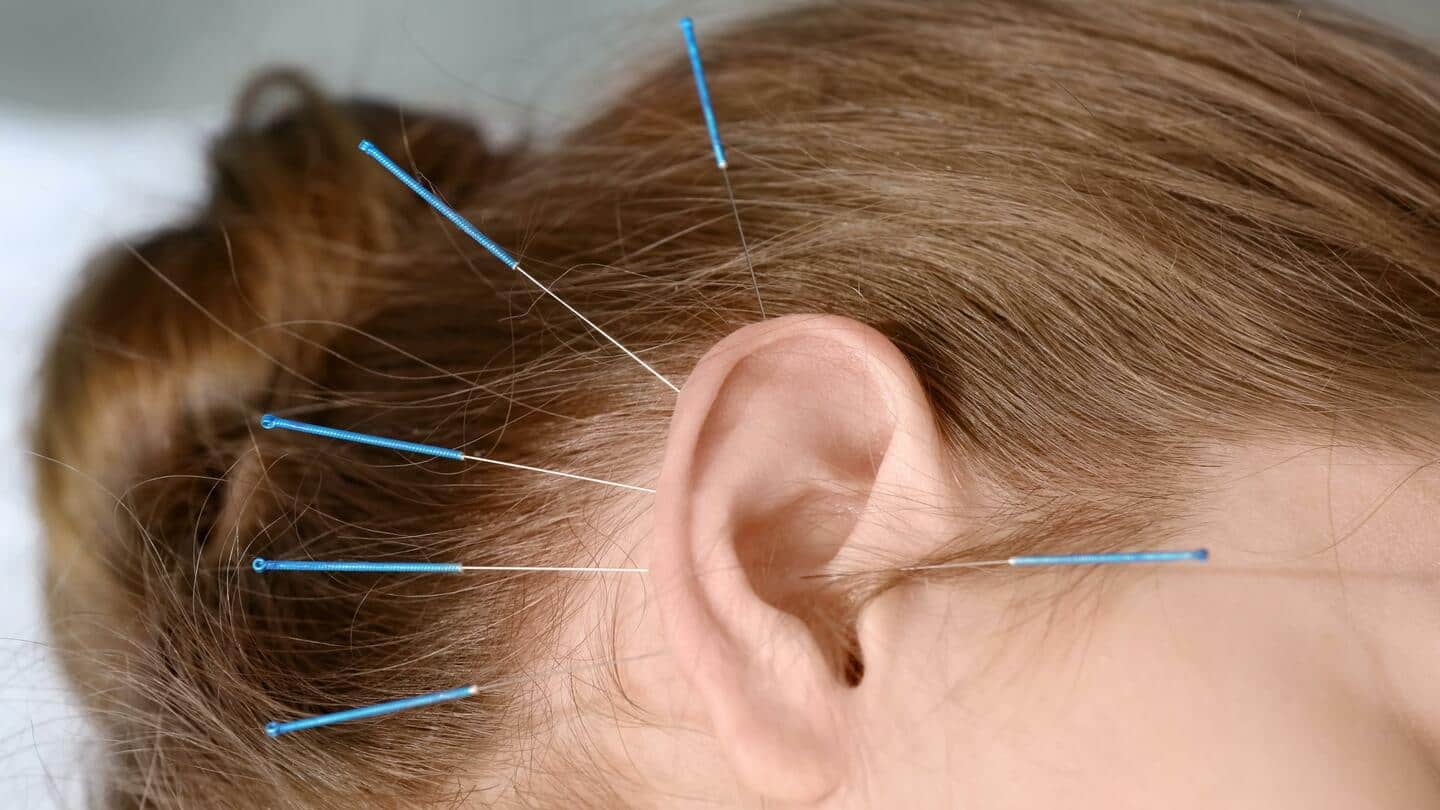 Did you know about these acupressure points on your ears?
