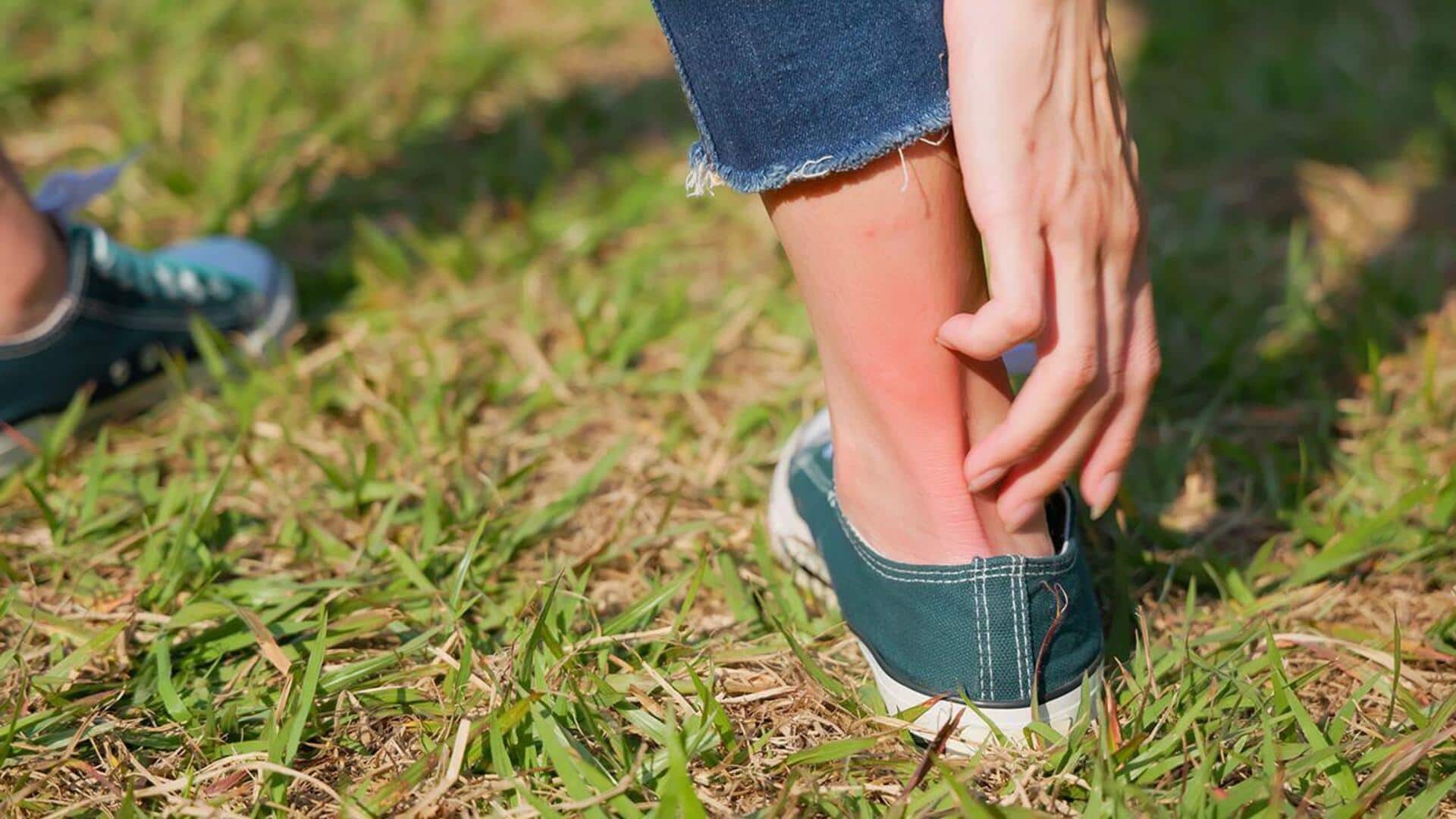 Fix itchy ankles with these home remedies