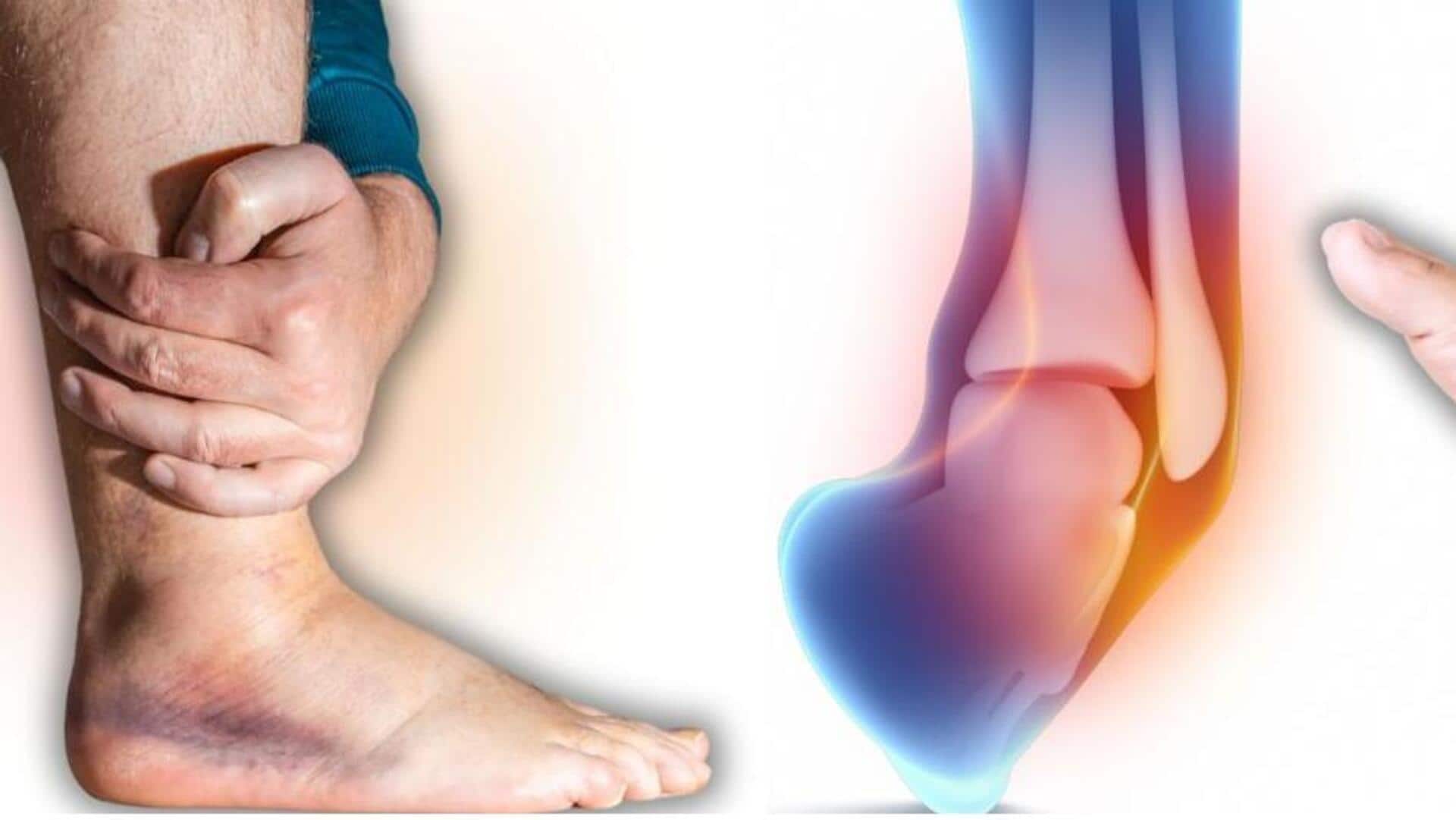 How to fix sprain pain with onion poultice