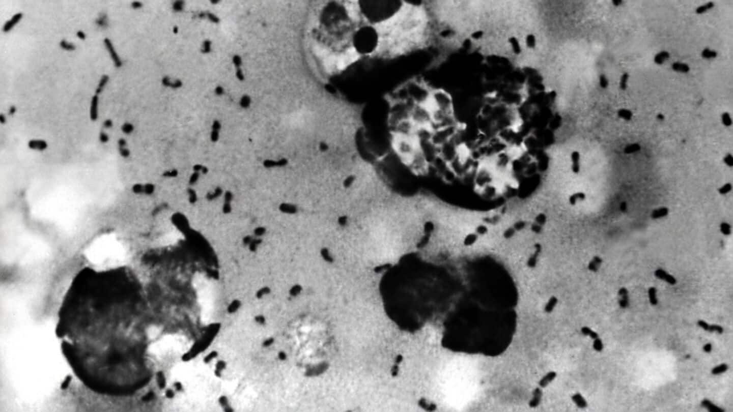 Understanding pneumonic plague: What is it, how dangerous is infection