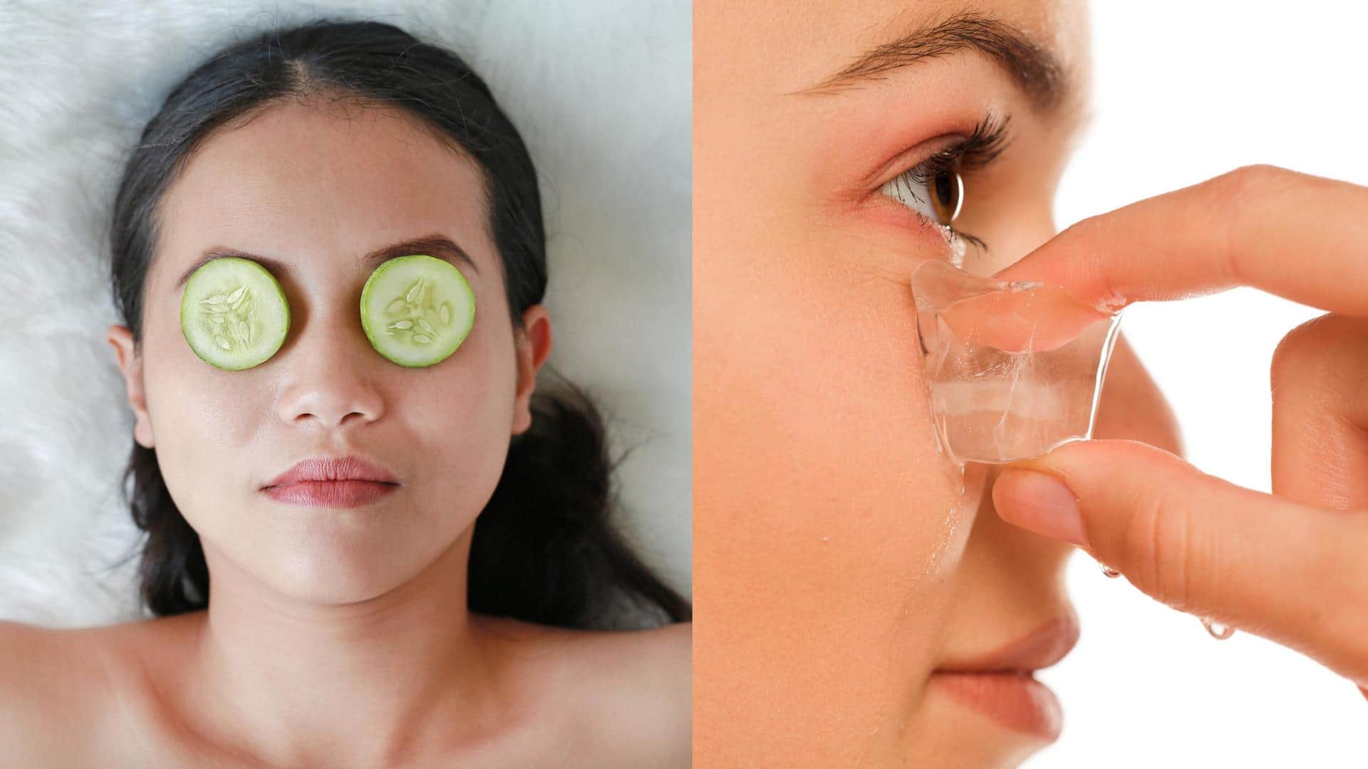 Under-eye bags: Home remedies to get rid of them