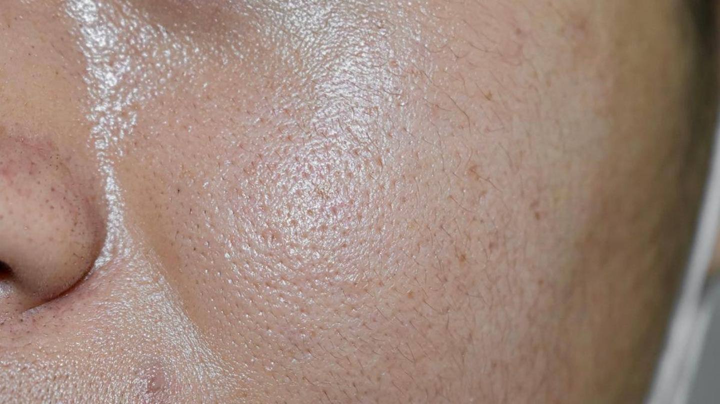 Know your skin type Know your skin type