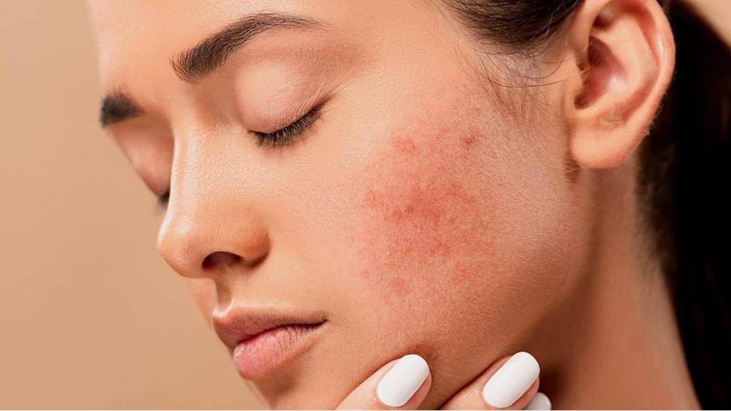Your purge can last for upto 28 days Your purge can last for upto 28 days